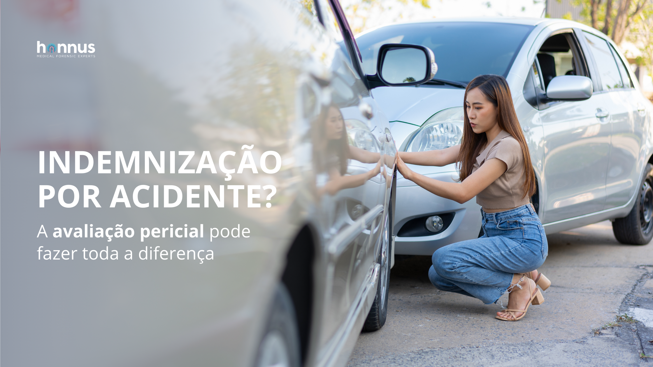 Processos de indemnização por acidente: quando é preciso um perito?